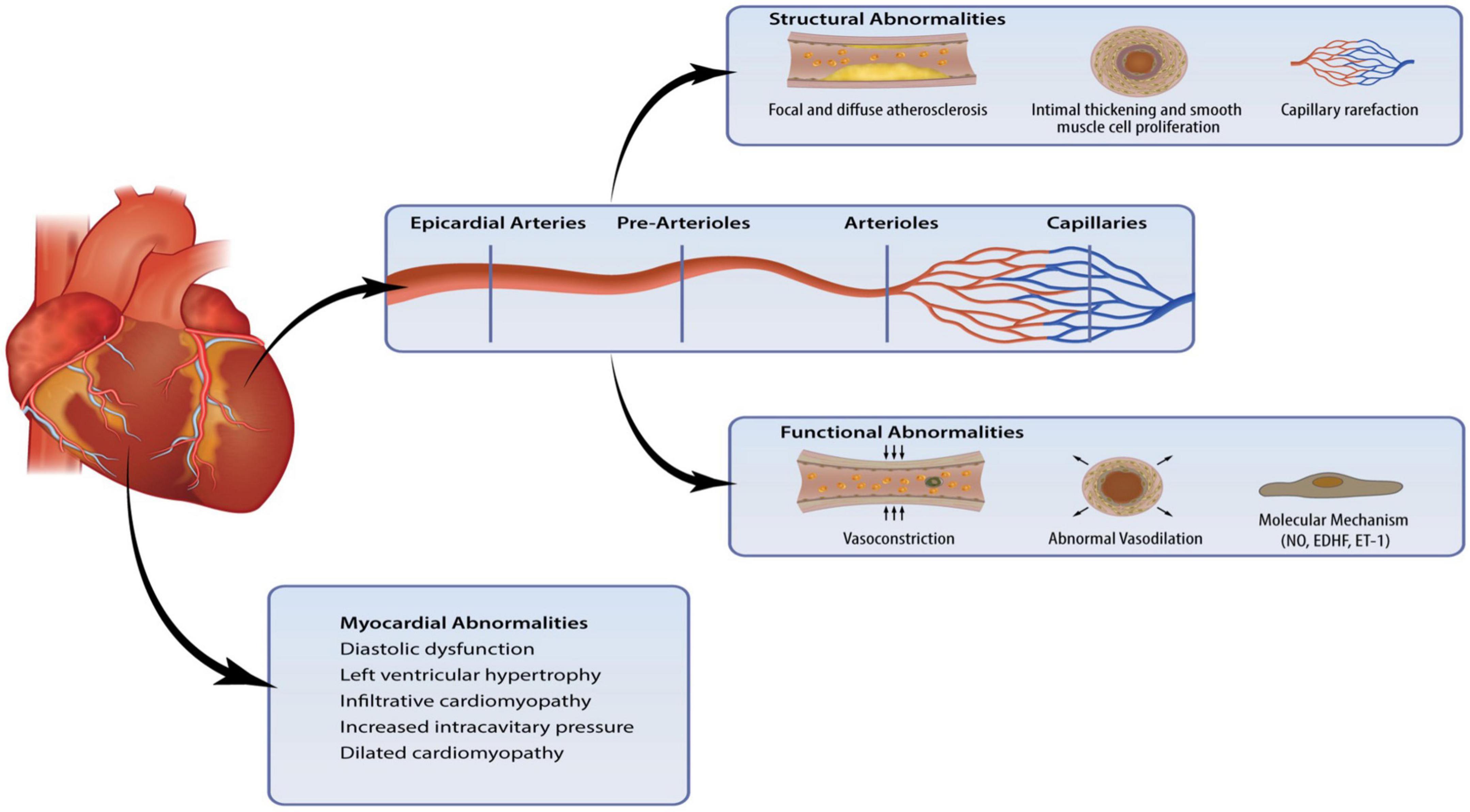 Coronary microvascular dysfunction: A review of recent progress and clinical implications